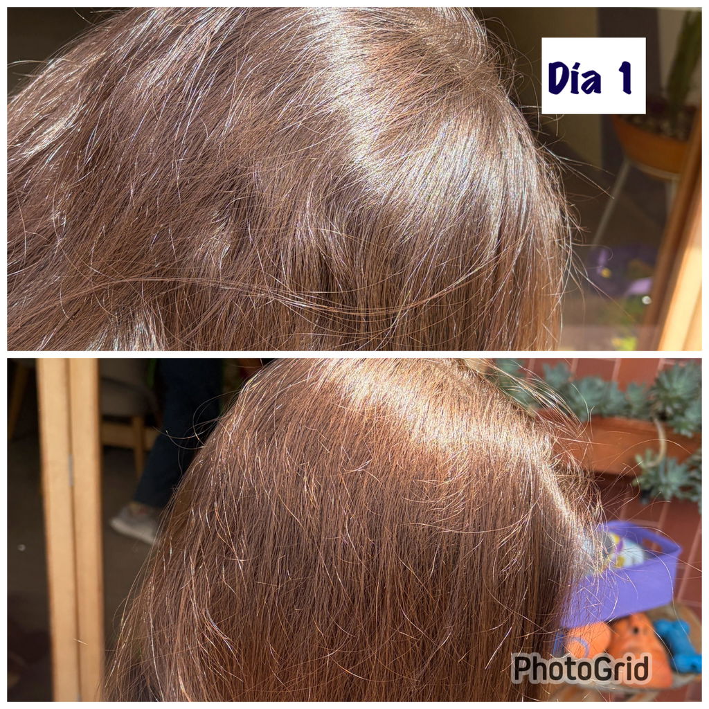 Tratamiento de Aclarado Progresivo ANHELI