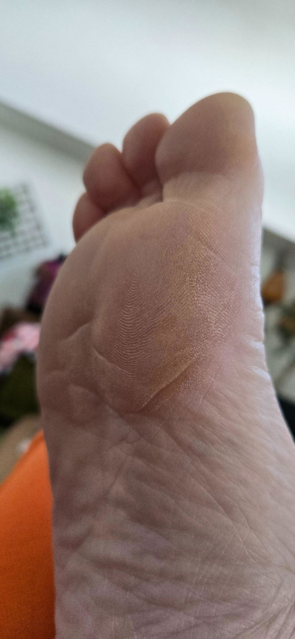 TrueLipids Ceramide+ Cream for Eczema-Prone, Dry, Itchy, and Sensitive Skin