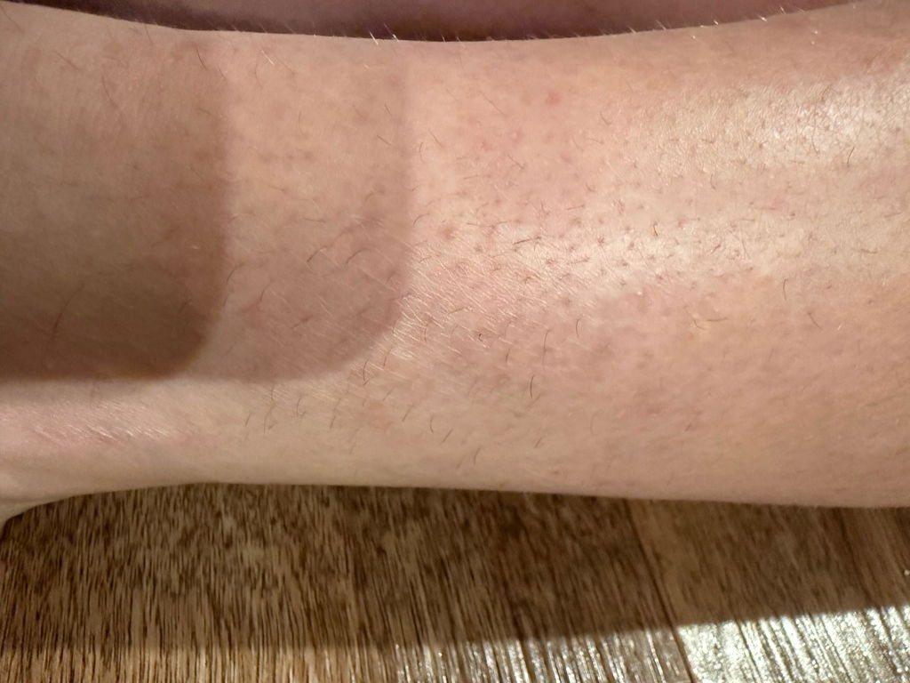TrueLipids Hydrocortisone Cream for Skin Barrier Support