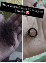 Natural Hair Growth Treatment Oil 🔥 Free Delivery  