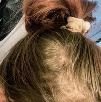 HairBoost