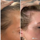 HAIR FOOD | MENO - 1 Month Supply