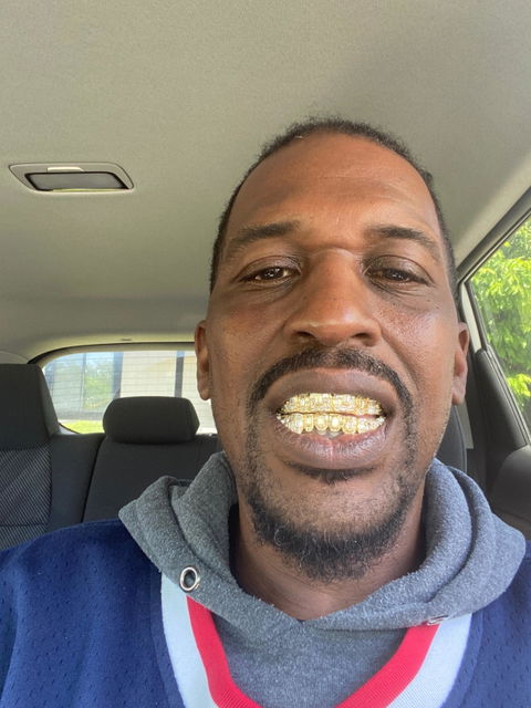 Custom Fully Iced Emerald Cut Grillz
