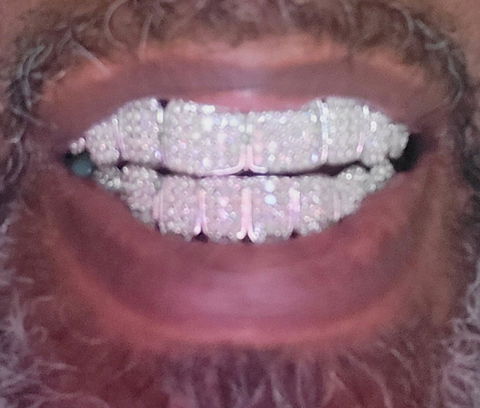 Custom Fully Iced Princess Cut Grillz