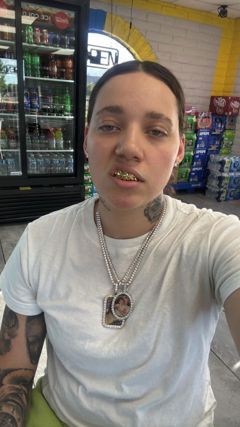 Custom Polished White Gold Grillz