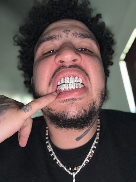Custom Fully Iced Honeycomb Rimless Setting Grillz