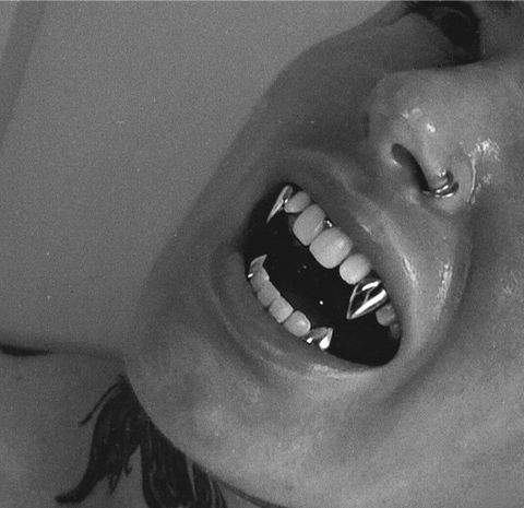 Custom Gold Fang Grillz