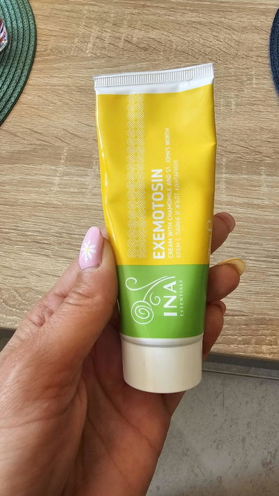 opinión de una clienta sobre la crema para psoriasis, eczema y piel irritada de InaEssentials
