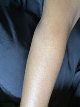 Regular Eczema Support Bundle