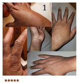 Eczema Relief Body Oil