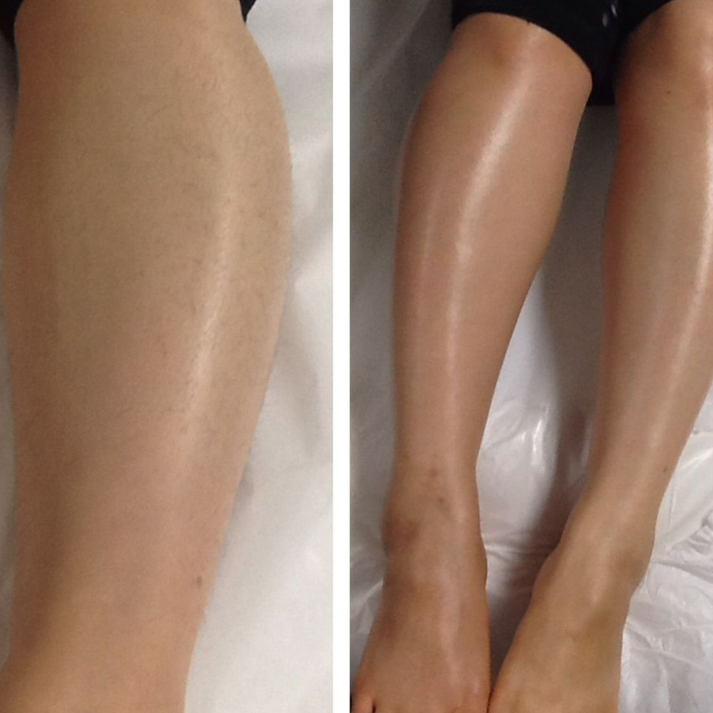 Customer skin result