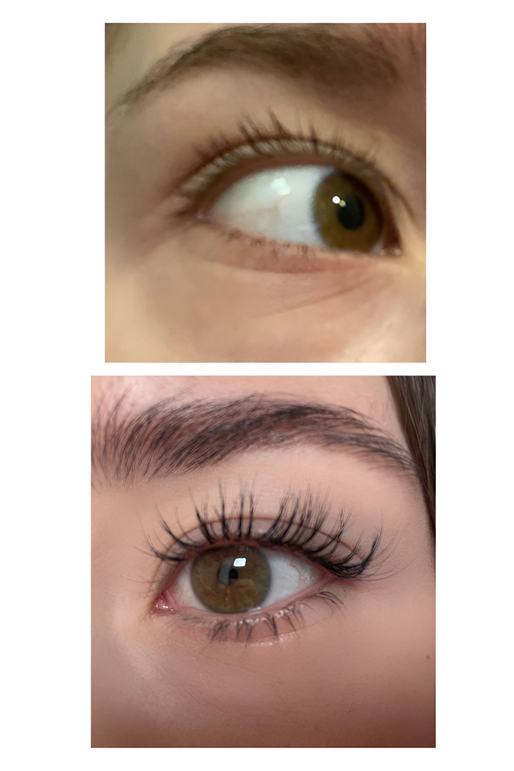 Skropstu Augšanas Serums