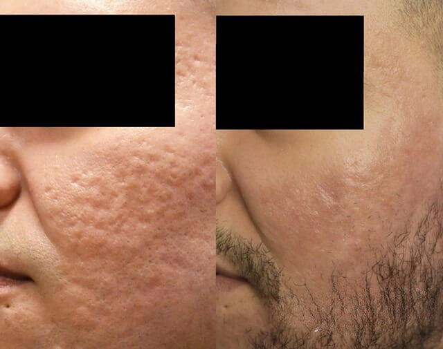 Review image from Tyler G.