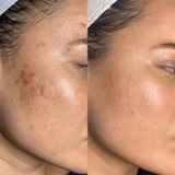 Dark spots are DISAPPEARING