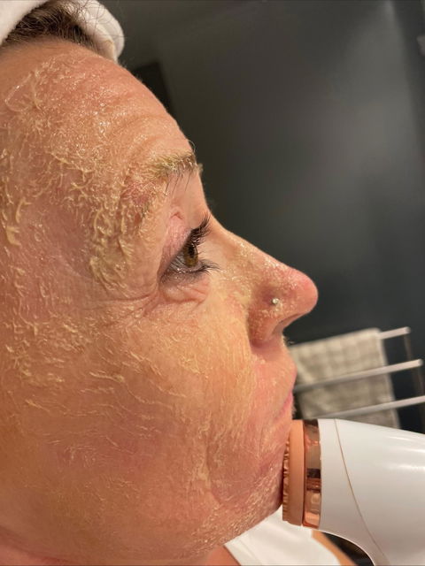 ageLOC LumiSpa & Lumi Spa iO Activating Cleanser