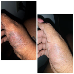 Review picture