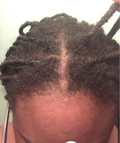 Review picture