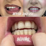 PAP Teeth Whitening Strips with Hydroxyapatite – 28 Strips (14 Day Treatment)