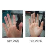 Kit para dermatitis y resequedad corporal
