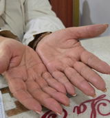 Kit para dermatitis y resequedad corporal
