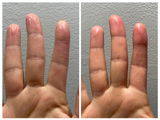 Kit para dermatitis y resequedad corporal