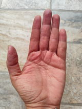 Kit para dermatitis y resequedad corporal
