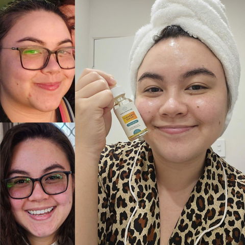 Turmeric Face Care Bundle