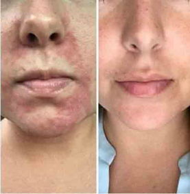 Customer result