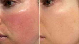Customer result