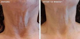Customer result