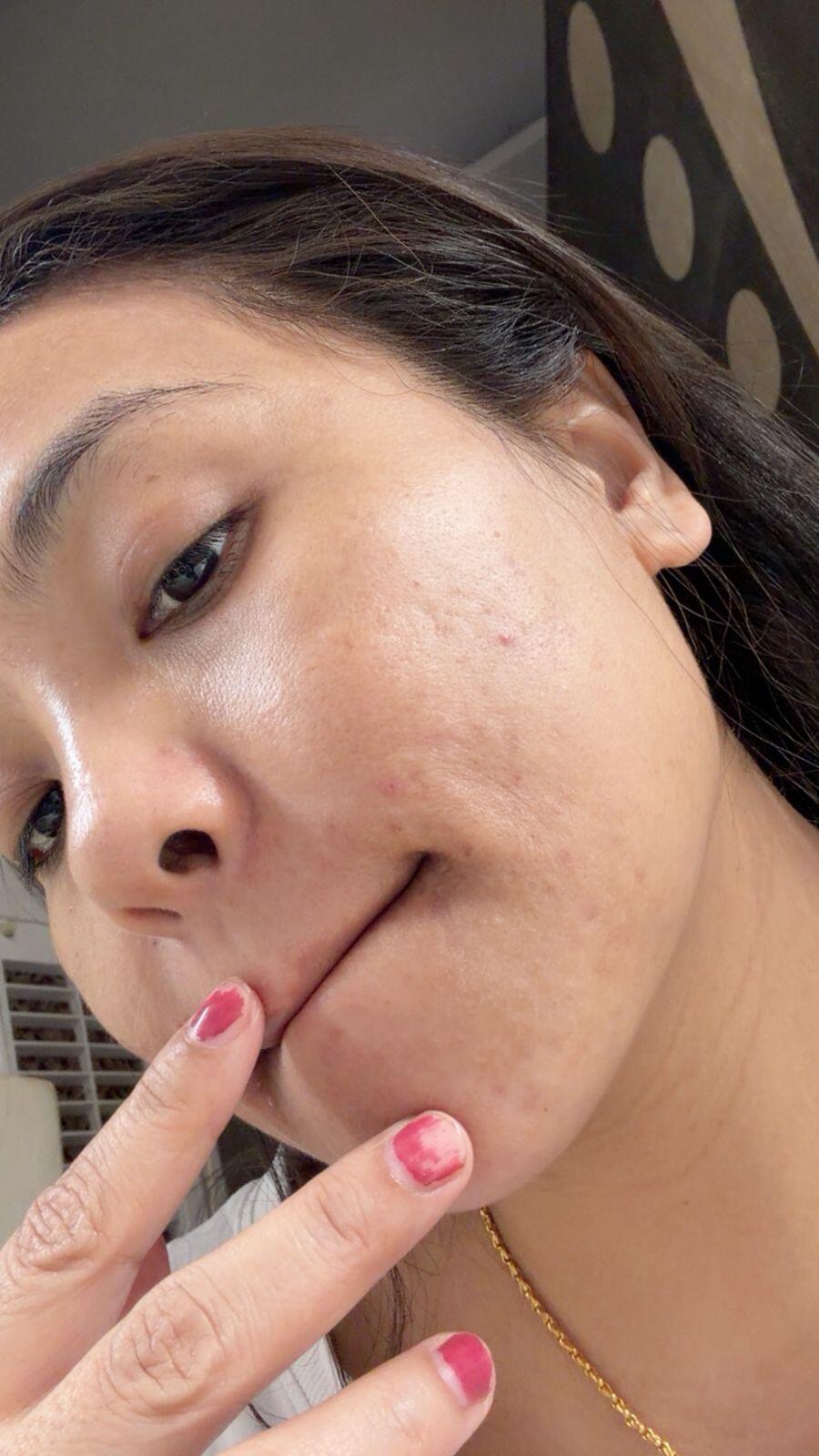 Rapid Clear Facewash