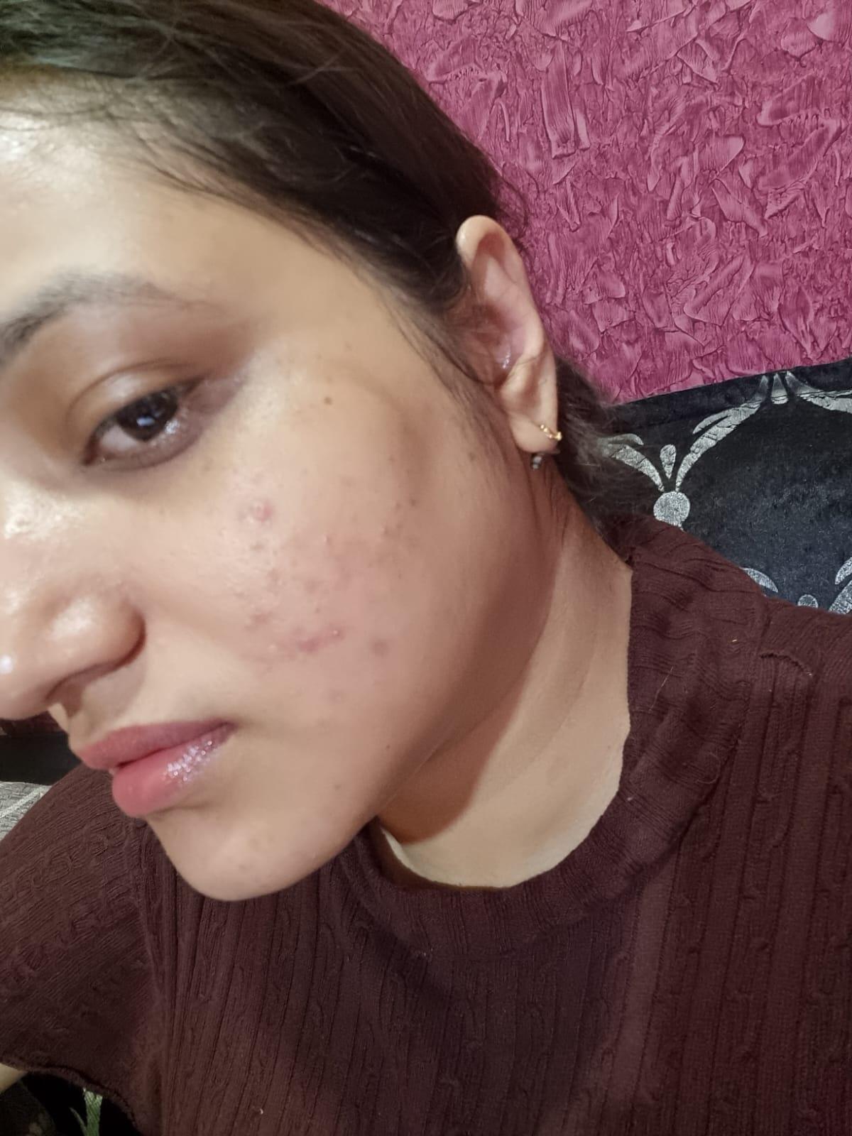 Rapid Clear Facewash