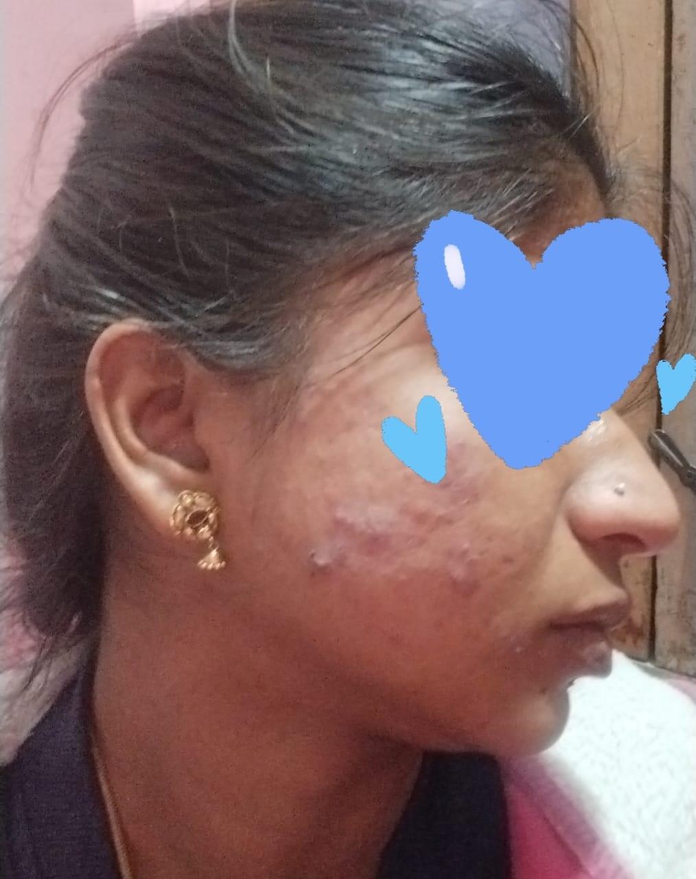 Rapid Clear Facewash