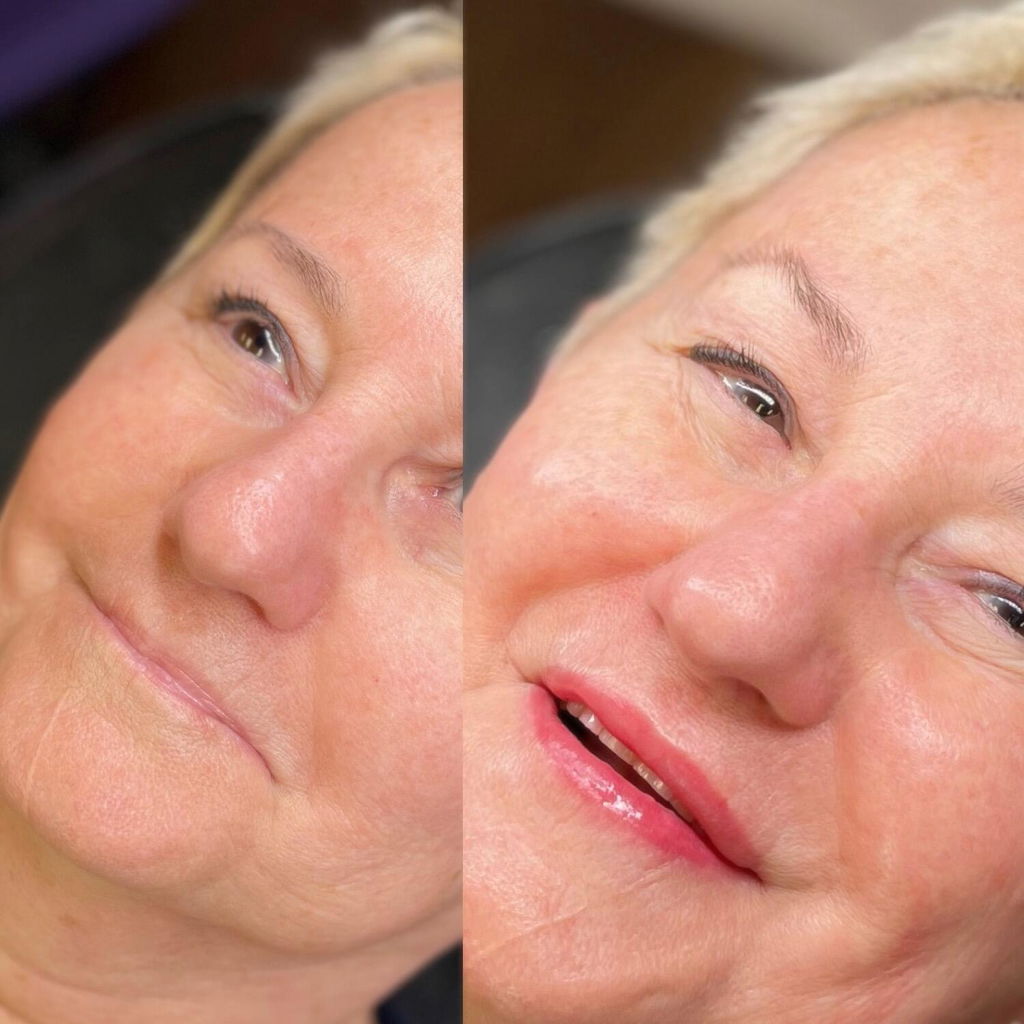 Aftercare Healing Gel
