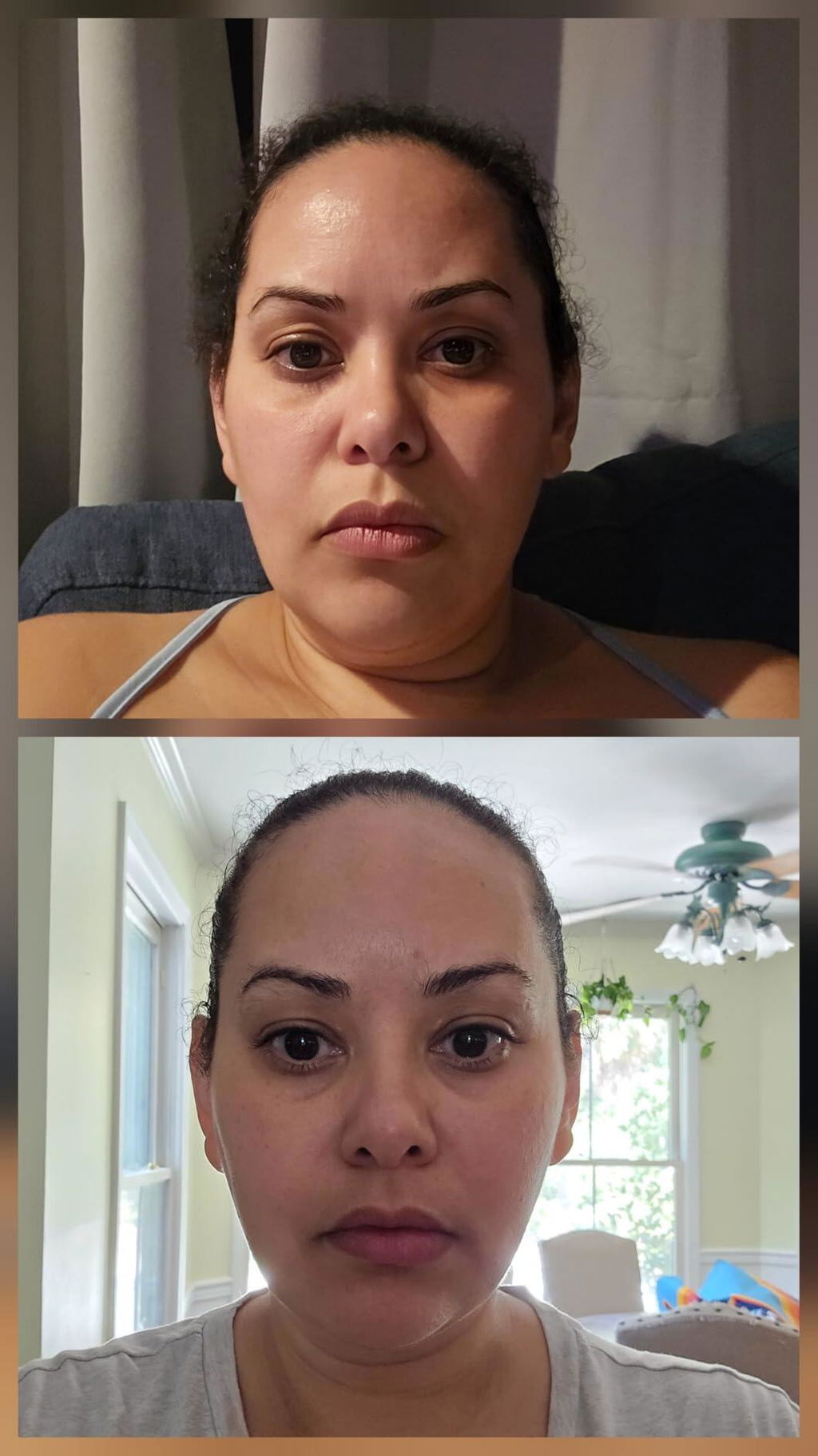 UpLift Lymphatic Drainage Drops