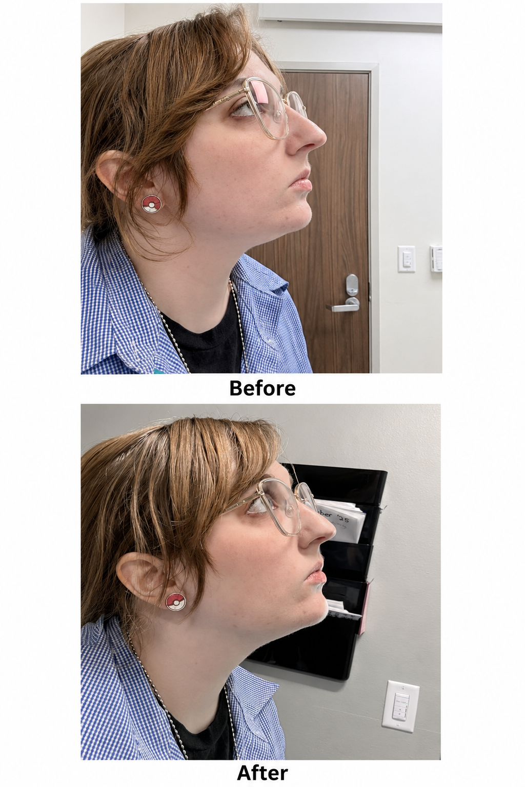 UpLift Lymphatic Drainage Drops