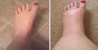 Customer review photo 4