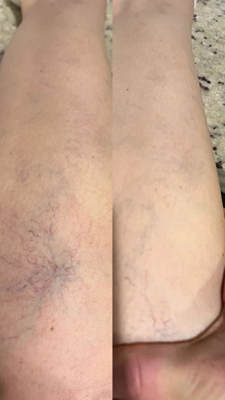 Customer review photo 3