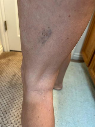 Customer review photo 2