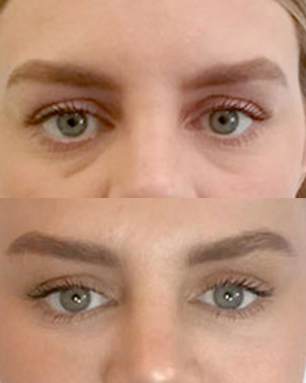 ISA ✨ VARITA MAGIC LED FACIAL